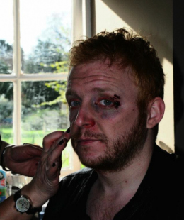 ryan-eye-1